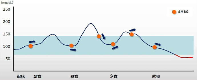 図1 '点'ではなく'曲線'で捉えることで1日の血糖の流れがより直感的に理解できる