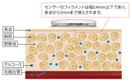 図1　CGMによる間質グルコース濃度の測定（アボット社資料より）