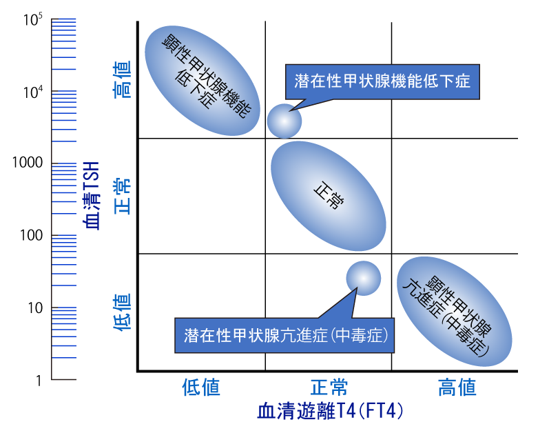 図1 甲状腺機能評価と疾患(筆者ら作成)