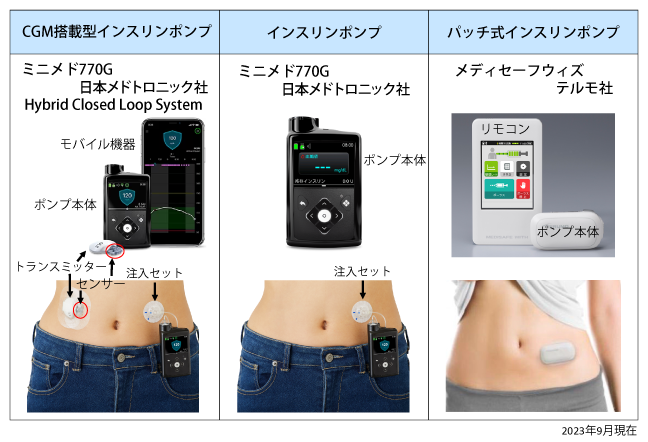  T2DM に対するインスリンポンプのリスク