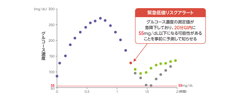 CGM「Dexcom G7」