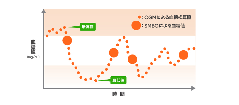 CGM「Dexcom G7」02