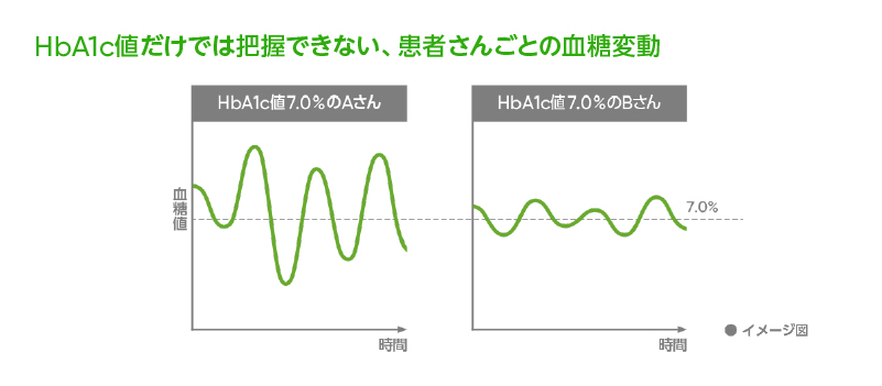 CGM「Dexcom G7」02