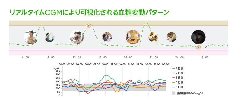 CGM「Dexcom G7」02