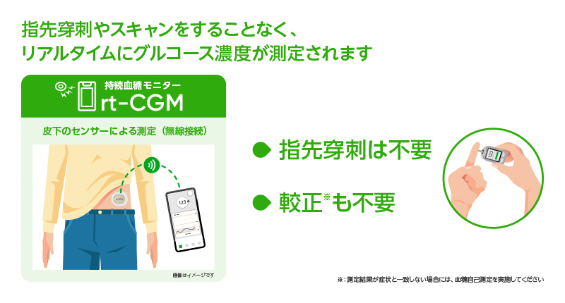 CGM「Dexcom G7」