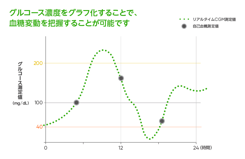 CGM「Dexcom G7」