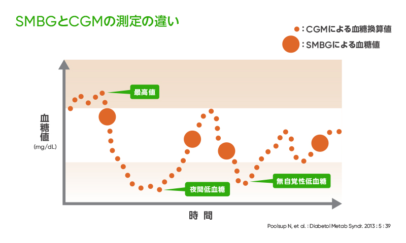 CGM「Dexcom G7」