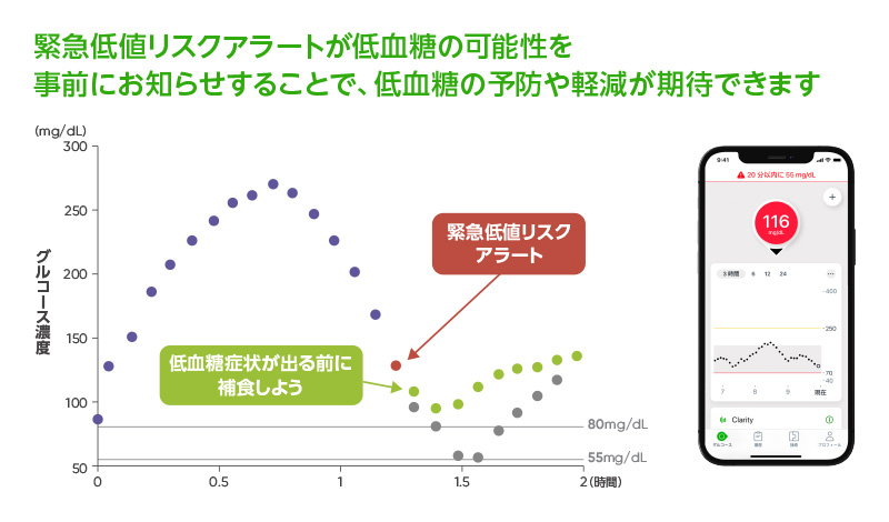 CGM「Dexcom G7」