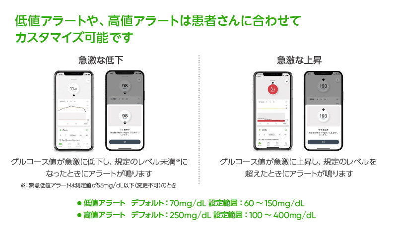 CGM「Dexcom G7」