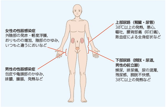 4. 糖尿病と尿路・性器感染症 ─SGLT2阻害薬使用時の注意点を含めて 