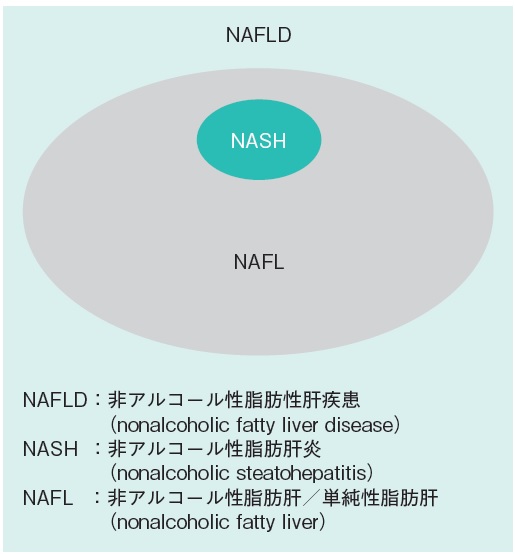 NAFLD/NASHの概要 | 糖尿病リソースガイド