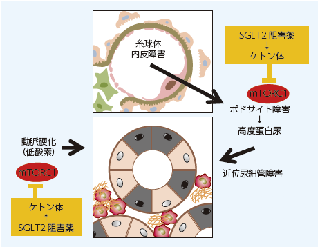 腎保護 ストア sglt2 枕電さ