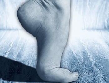 糖尿病足病変スクリーニングで17％に心房細動を発見  糖尿病リソース 